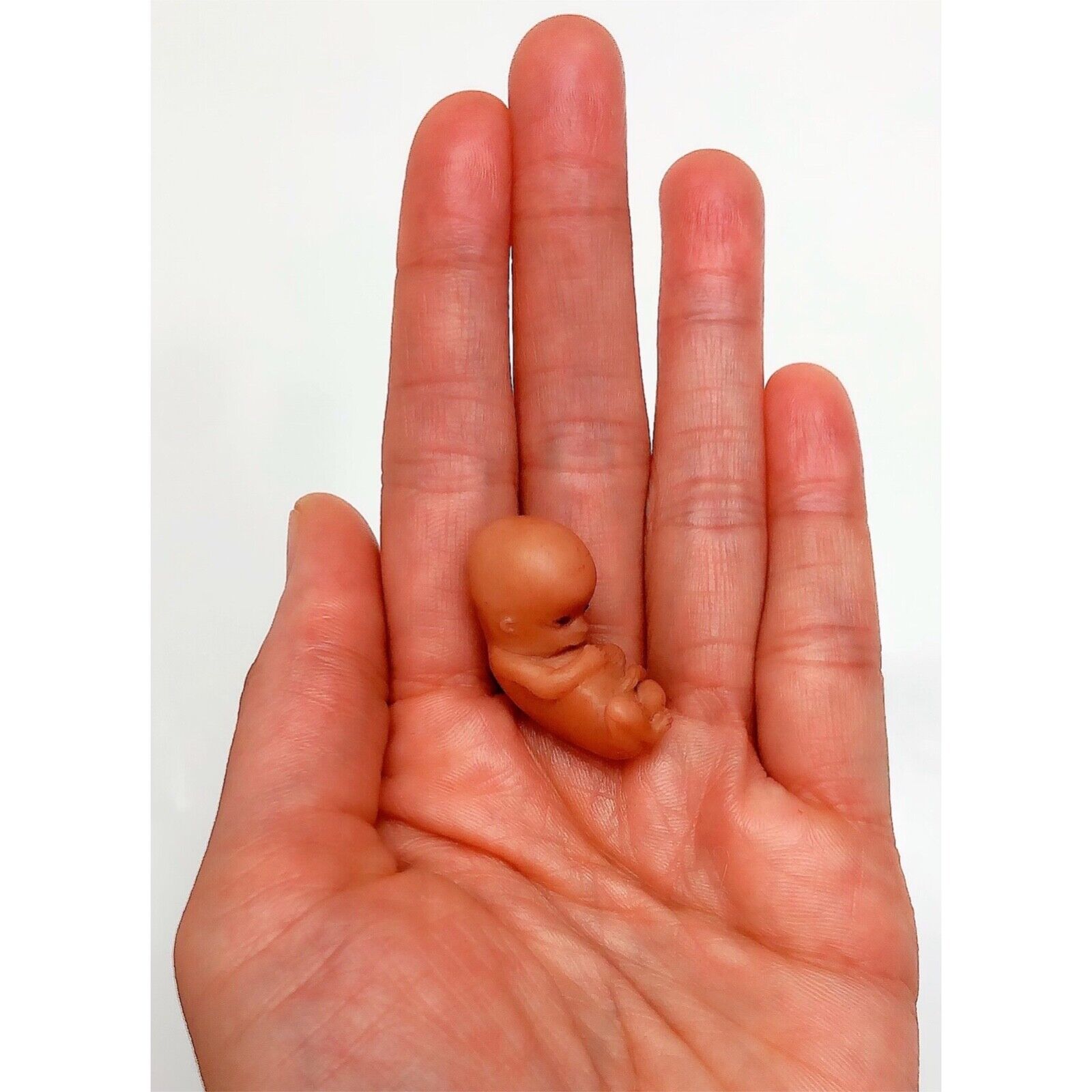 10 Weeks Baby Fetus, Stage of Fetal Development (Memorial/Miscarriage/Keepsake)