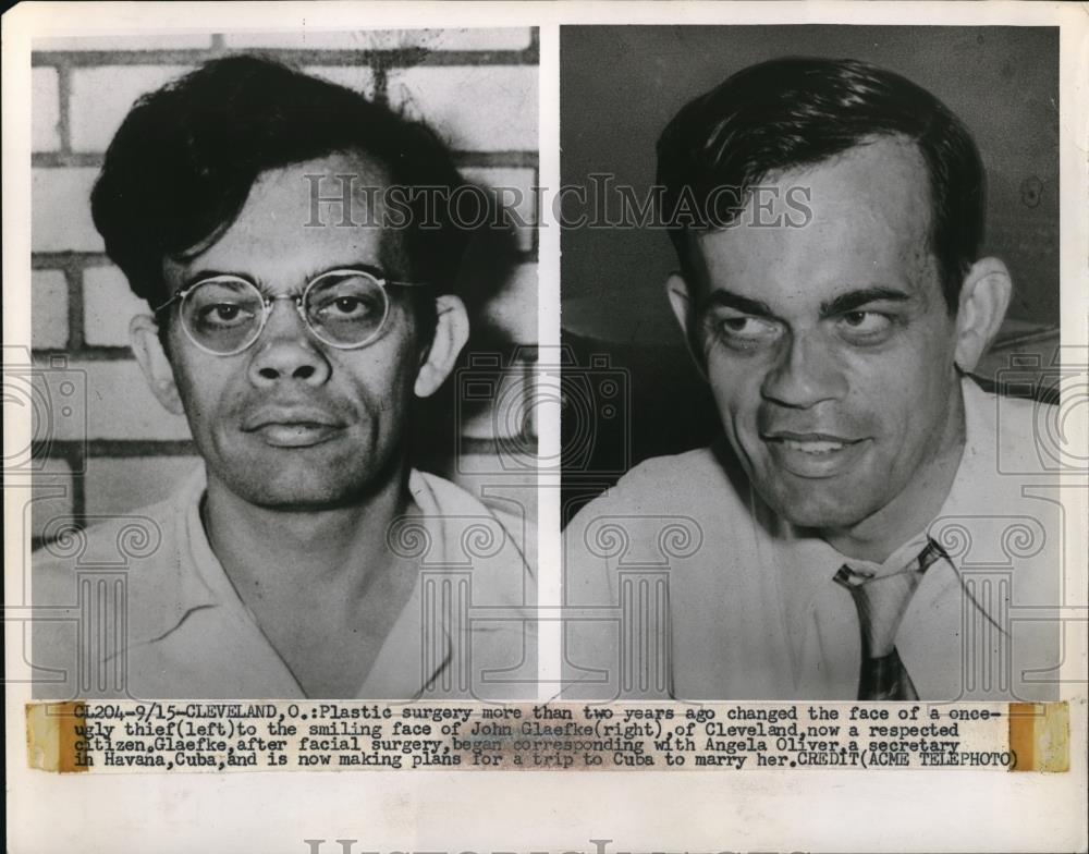 1951 Press Photo Cleveland Ohio Plastic surgery changed face of once ugly thief