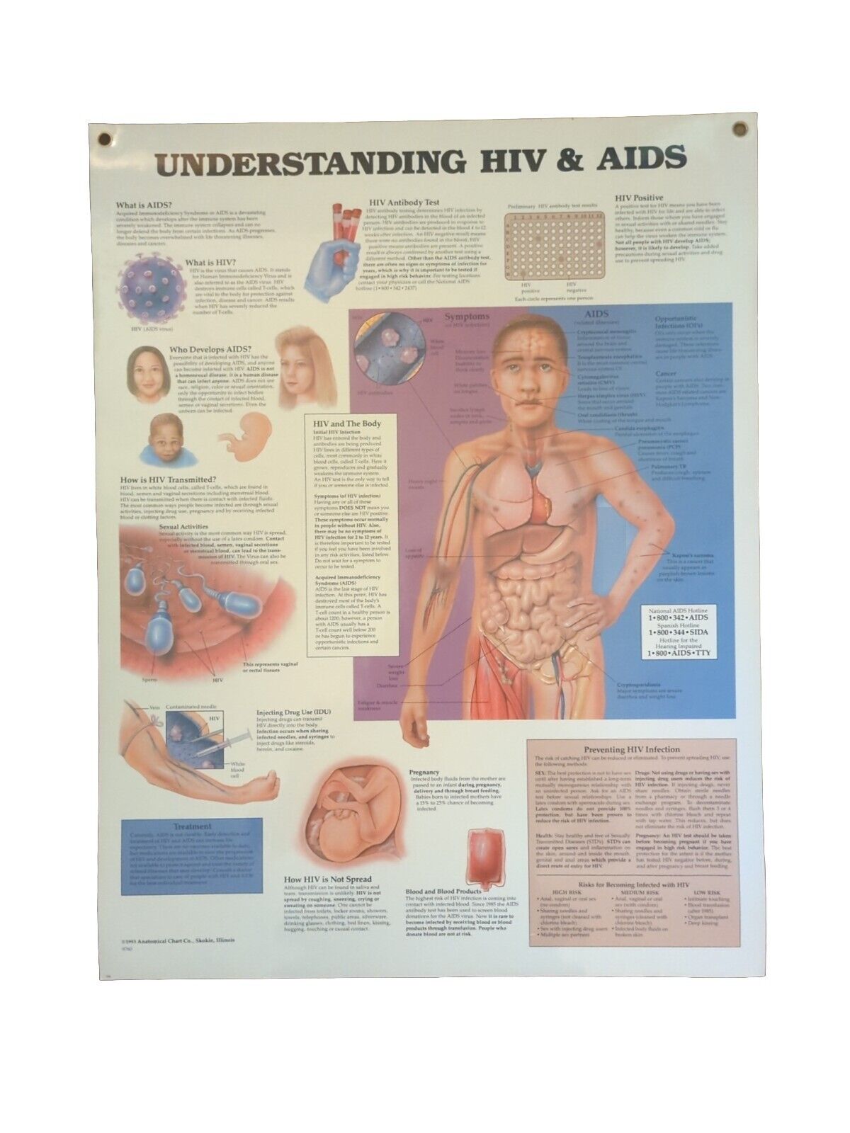 Vintage 1993 Anatomical Chart CO. “Understanding HIV & AIDS” 26x20 