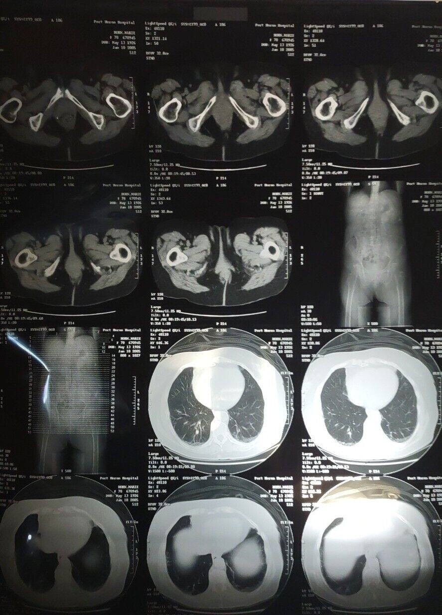 MRI & CAT Scan Images Medical Anatomy - Cervical Spine, Torso, Organs Lot Of 31