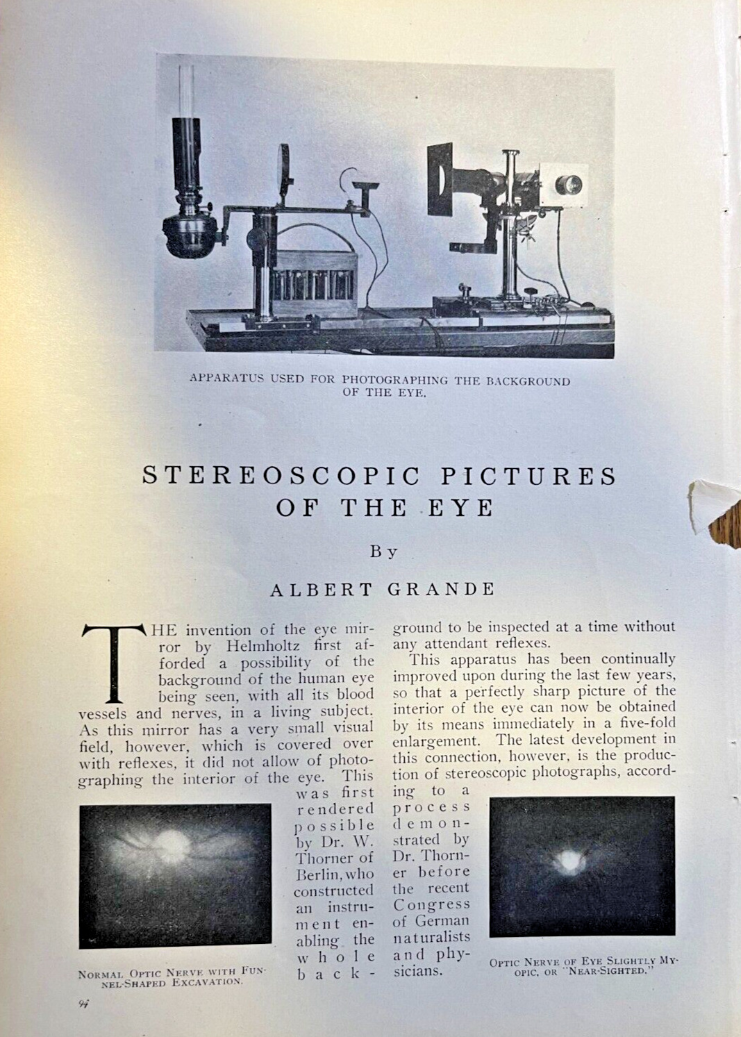 1911 Dr. W. Thorner Stereoscopic Pictures of the Eye illustrated