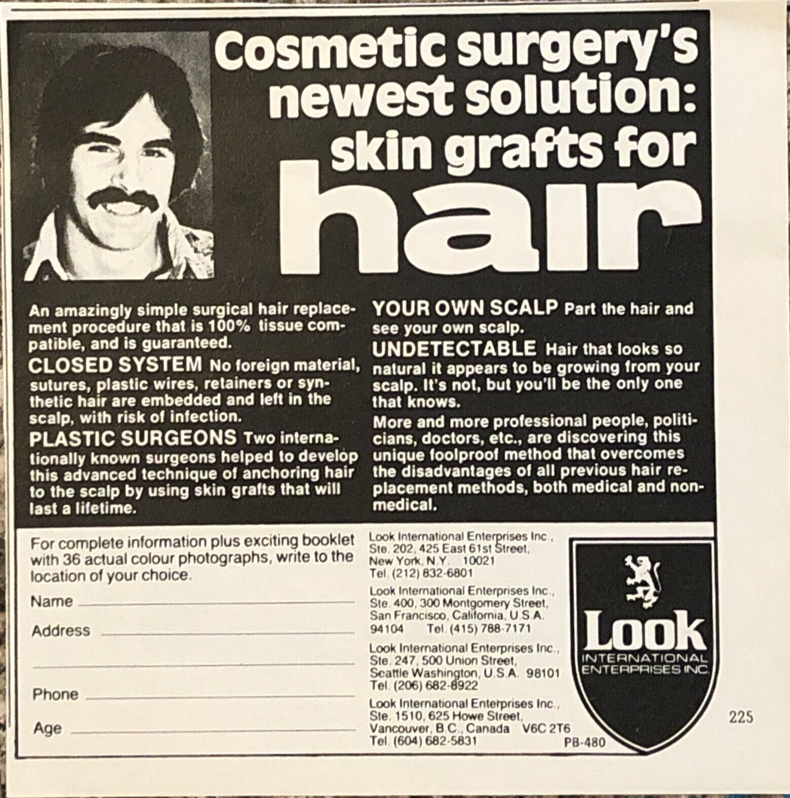 1980 Look International Hair Grafts VTG 80s PRINT AD Cosmetic Surgery 5.5x5.5