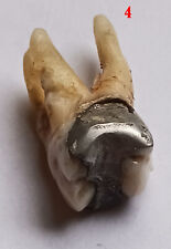 RARE Antique HUMAN Tooth/Teeth MOLAR w/ROOTS  SILVER Filling picture