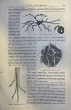 1862 Physiology Medicine What Are Nerves illustrated picture