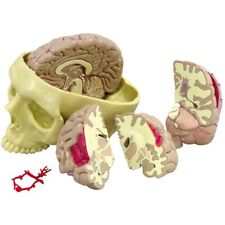 Brain Diseased Anatomical Model   GPI  LFA #2900 SEE VIDEO picture