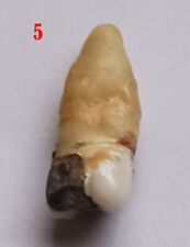 RARE Antique HUMAN Tooth/Teeth MOLAR w/ROOTS  SILVER  Filling #5 picture