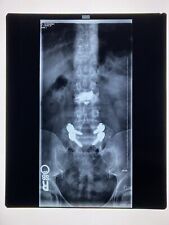 Xray film, x-ray, Used, Oddity, Medical, Surgical, Funeral - 14 x 17 MRI - SPINE picture