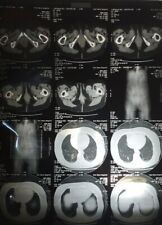 MRI & CAT Scan Images Medical Anatomy - Cervical Spine, Torso, Organs Lot Of 31 picture