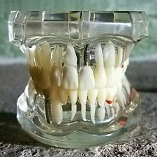 Disease Teeth Model, Clear Dental Teeth Model, Vintage Medical, Oddities, Weird picture
