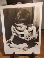 1965 Pres Photo The Birth Defects Of Thalidomide Drug By Wild World Photo picture