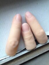 finger prosthetic finger prosthetics fingers prosthesis fingertip prosthesis picture