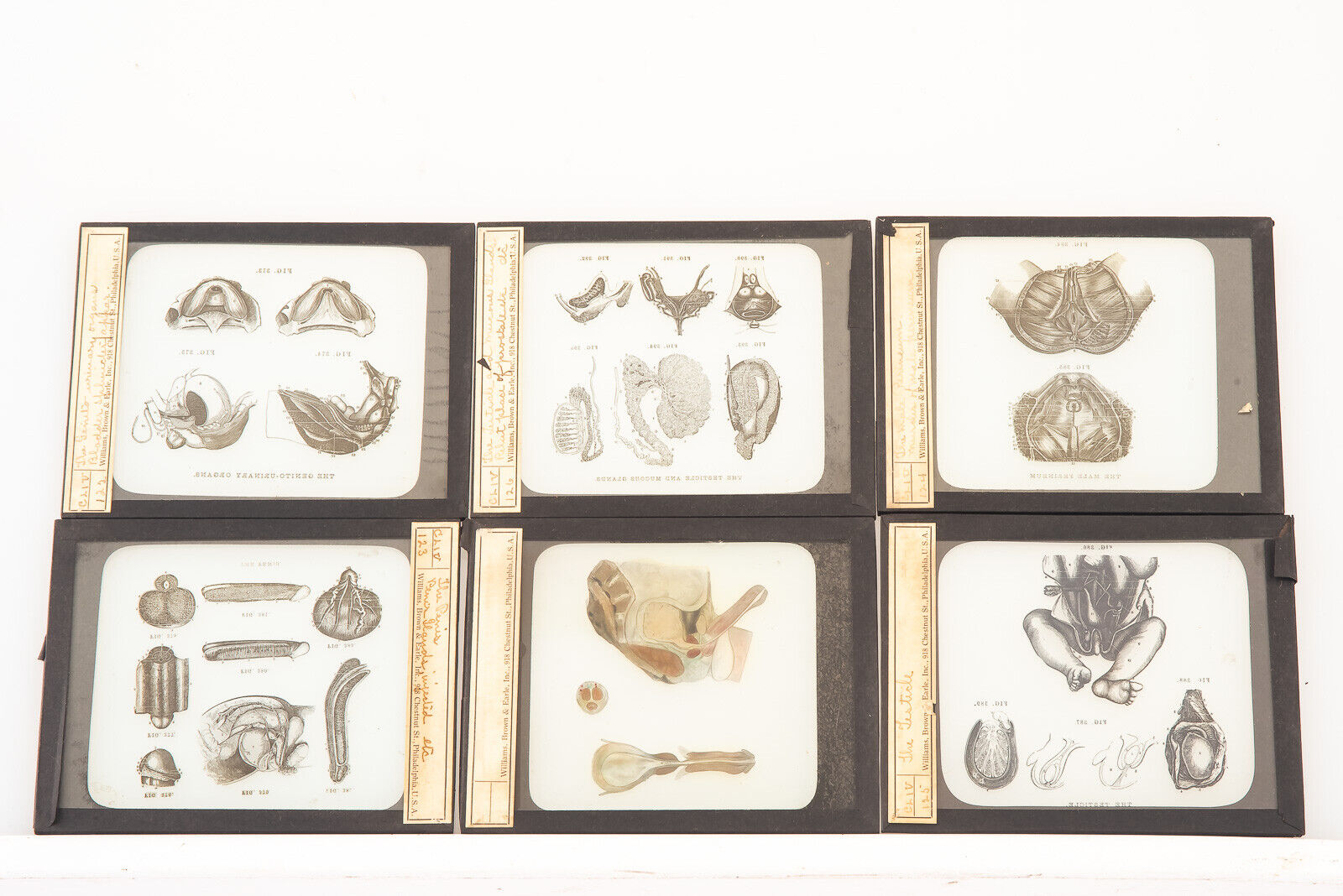 Rare Magic Lantern Slides Set of 6 Medical Reproductive 1900\'s 4 x 3 1/4\