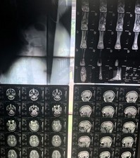Mystery Medical Radiology Imaging Film Sheet/ X-Ray MRI CT Scan picture