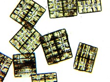 Antique Microscope Slide. Diatoms Terpsinea Musica picture