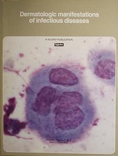 Dermatologic manifestations of infectious diseases (A Scope publication) picture