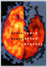 Dual View MRI Brain Scan Normal no Drugs and Abnormal on Ecstacy Ad Postcard picture
