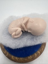 Angel Baby, 12-14 weeks Baby loss Keepsake, Miscarriage,Memorial, Remembrance picture