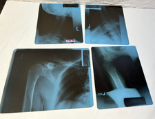 4 Real MRI M R I Film Physical Scan Image Medical X-ray* picture