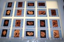 375 Medical Brain Disease Study 35mm Slides Lot Neuroscience Dissection Oddity picture