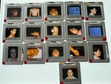 16 METAL COSMETIC SURGERY MEDICAL WEIRD STRANGE VINTAGE COLOR SLIDES picture