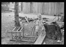 Mississippi County Arkansas 1935 Sharecropper Child Rickets Malnutrition picture