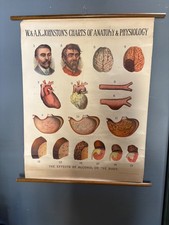 Antique W & A K Johnston Effects of Alcohol on the Body Physiology Chart picture