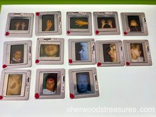 13 COSMETIC SURGERY MEDICAL WEIRD STRANGE VINTAGE 50s METAL COLOR SLIDES picture